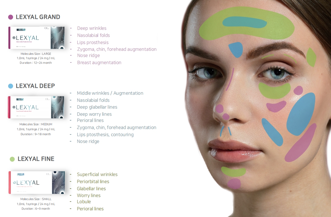 LEXYAL Filler with CE (No lidocaine)